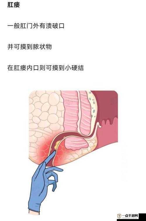 小女孩叉开腿后肛门微开是否正常：医学角度的探讨